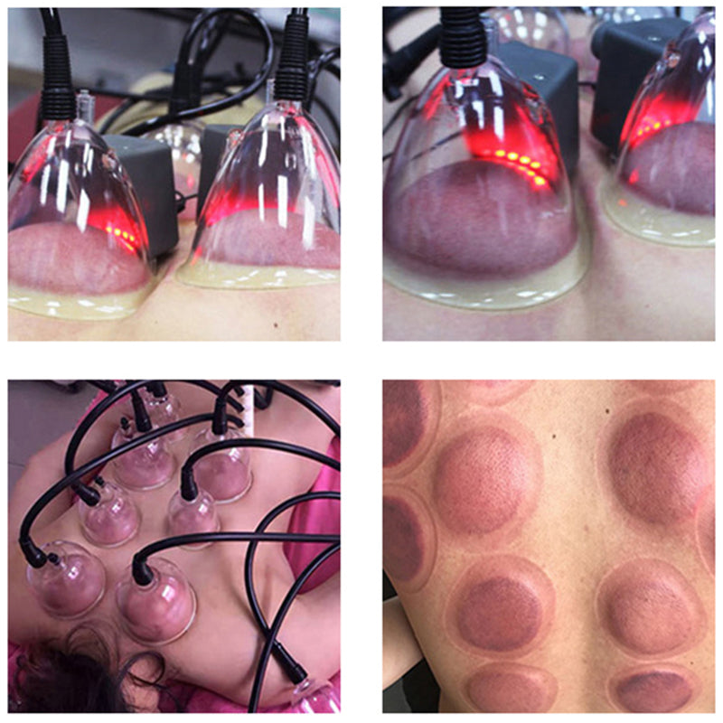 Body sculpting massage machine rf vacuum butt lift lifting breast augmentation enlargement enhancement massager cupping therapy