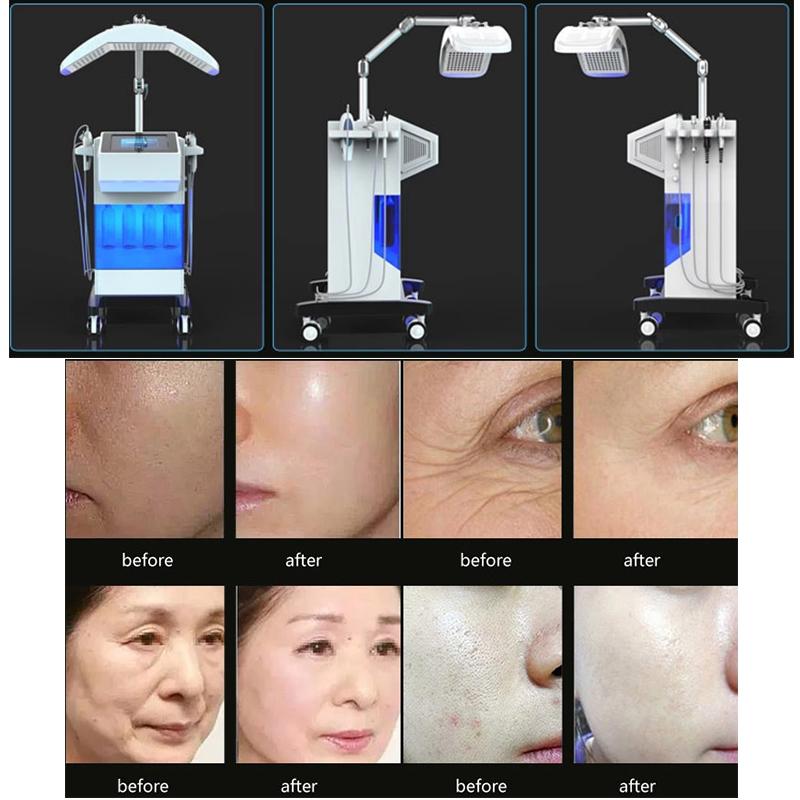Skin clean deeply Aqua Facial H2O2 Photon LED Oxygen Mask 8 in 1 Dermabrasion Facial Machine
