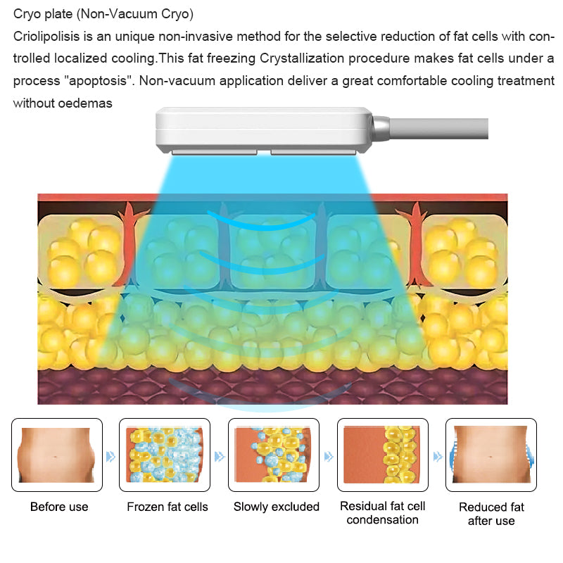 Cryoskin Toning CryoSlimming body Slimming machine reduce cellulite skin tightening Cooling equipment cryo ems apparatus