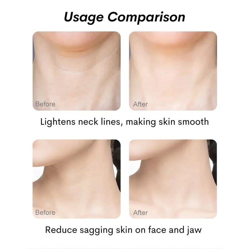 Face & Neck Skin Rejuvenation Bundle
