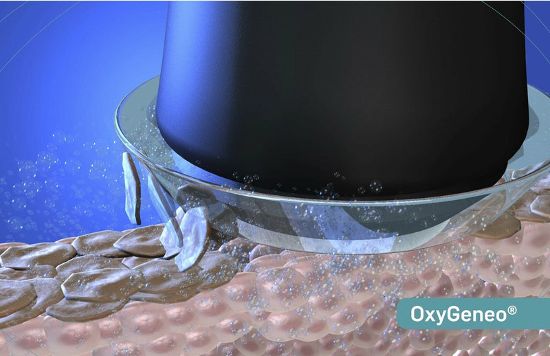Geneo Facial CO2 Oxygen Capsule Bubble Machine 3 in 1 RF Ultrasonic Anti Wrinkle