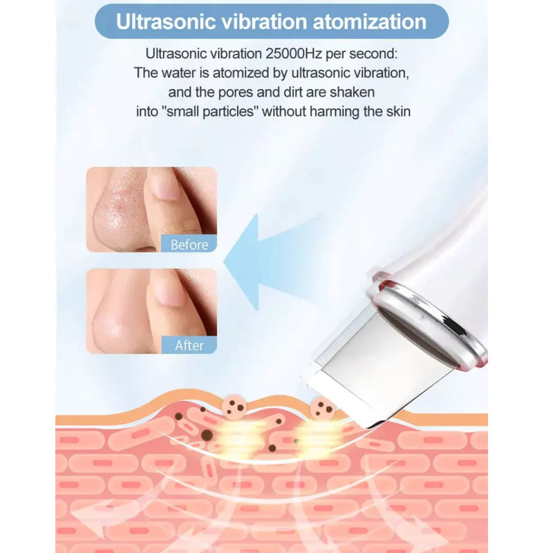 Water Peeling Ultrasonic Skin Scrubber